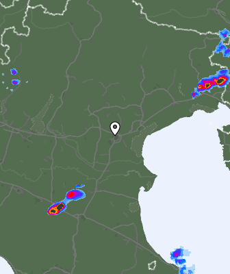 Radar