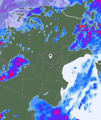Radar