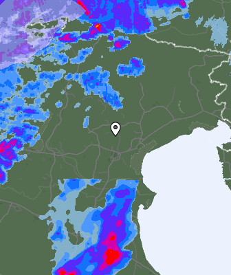 Radar
