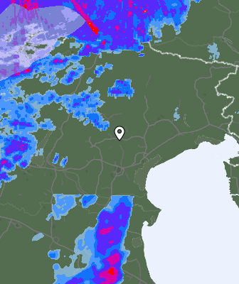 Radar