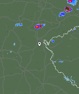 Radar
