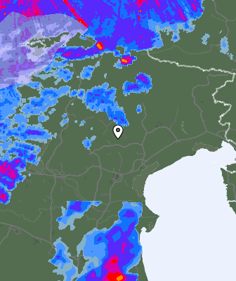 Radar