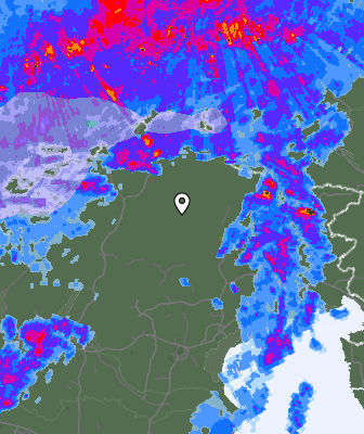 Radar