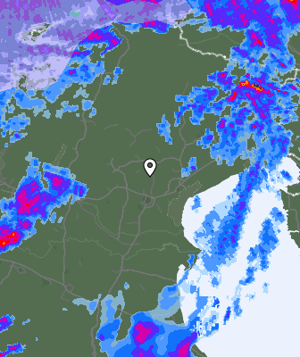 Radar
