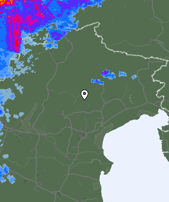 Radar