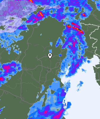 Radar