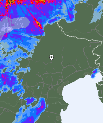 Radar