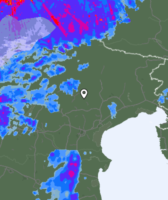 Radar