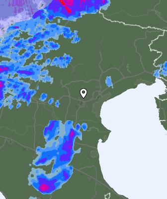 Radar