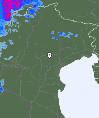 Radar