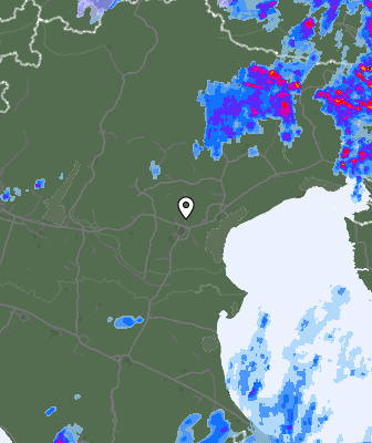 Radar