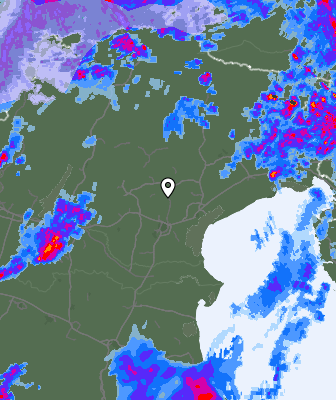 Radar