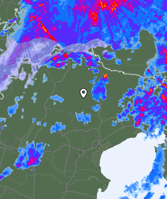 Radar