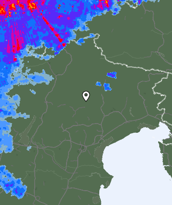 Radar