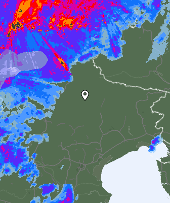 Radar