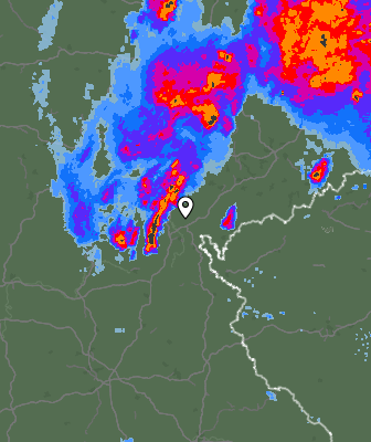 Radar