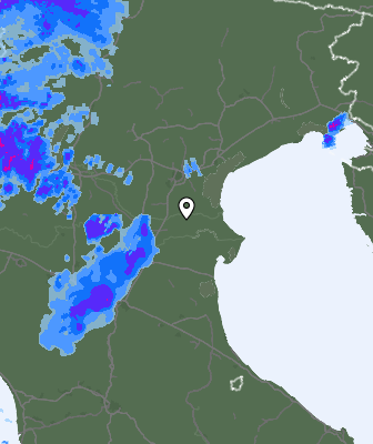 Radar