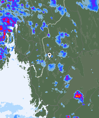Radar