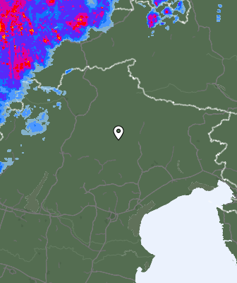 Radar