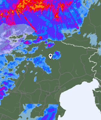 Radar