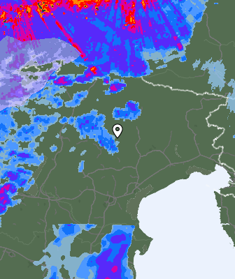 Radar