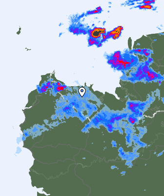 Radar