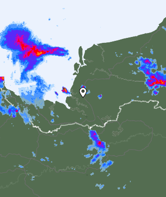 Radar