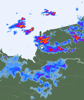 Radar