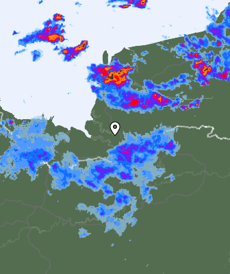 Radar