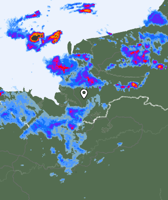 Radar