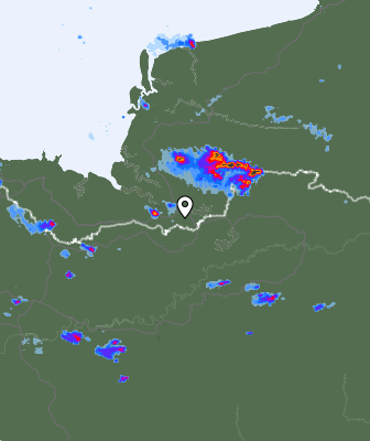 Radar