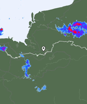 Radar
