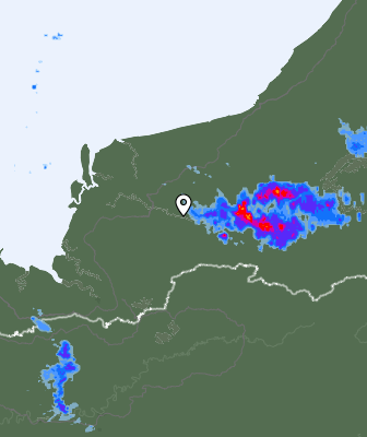 Radar