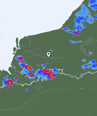 Radar
