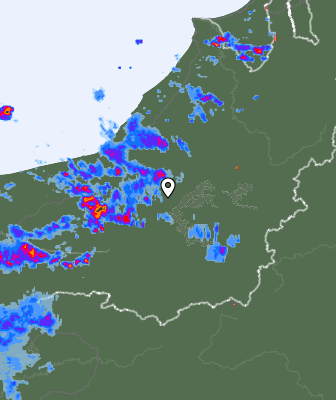 Radar