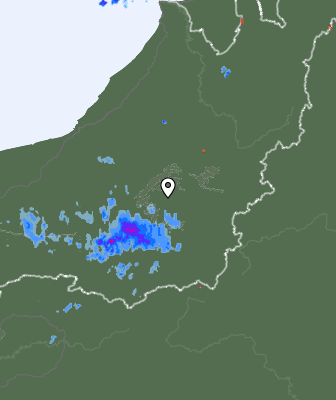 Radar