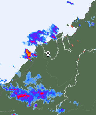 Radar