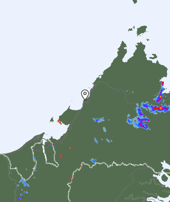 Radar