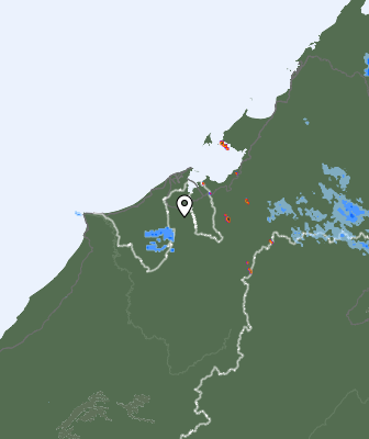 Radar