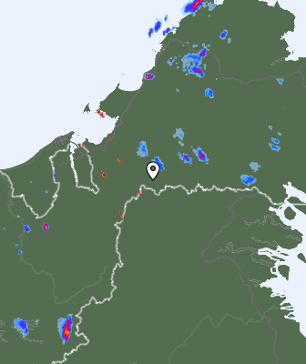 Radar