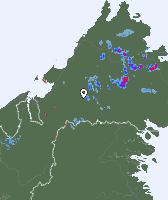 Radar