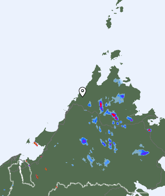 Radar