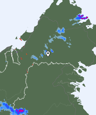 Radar
