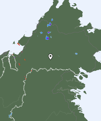 Radar