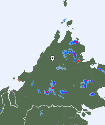 Radar