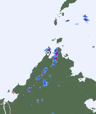 Radar