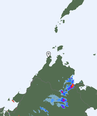 Radar