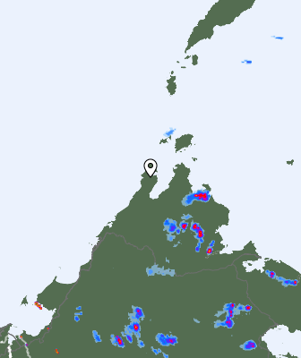 Radar