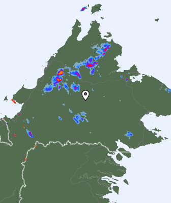 Radar