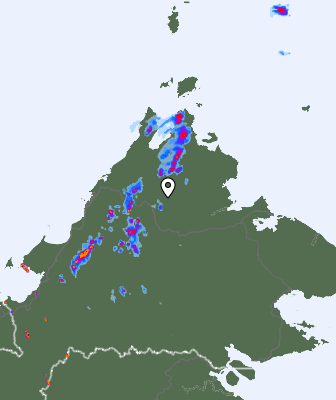 Radar